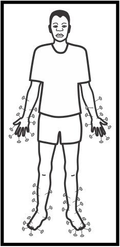 Peripheral neuropathy