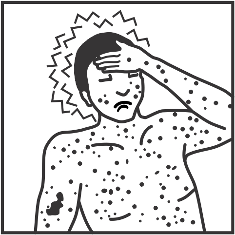 Rash and fever