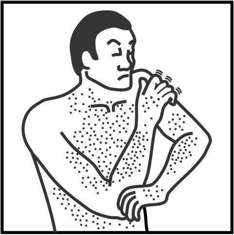 Skin rash-part of body